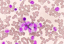 Bexobrutideg Produces Rapid and Durable Responses in CLL