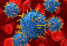 Second-Generation CAR T-Cell Therapy Effective in Relapsed/Refractory MCL